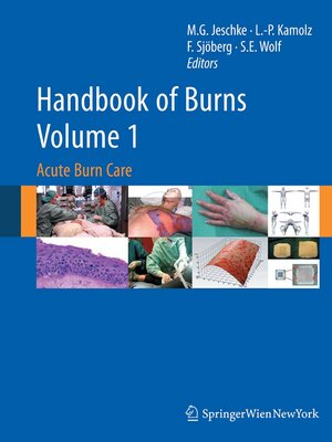cover image of Handbook of Burns, Volume 1